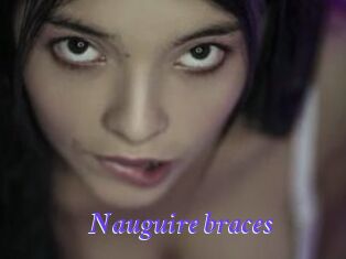 Nauguire_braces